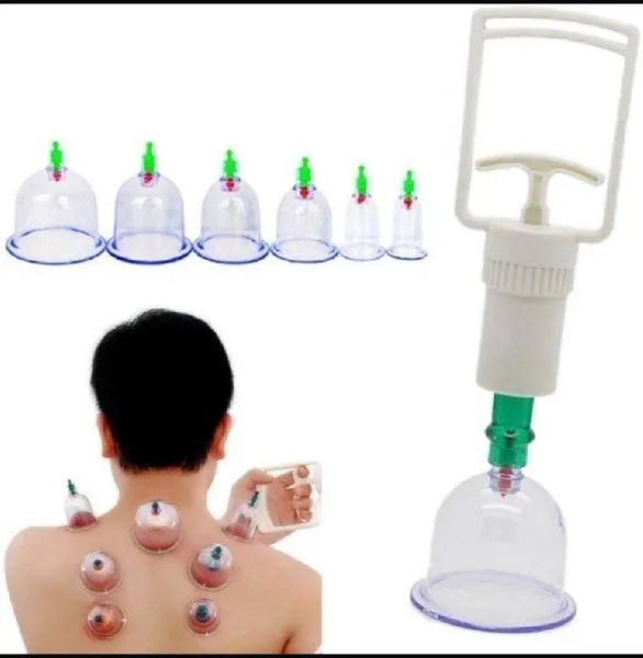 6 Pcs Cupping Set | 1423