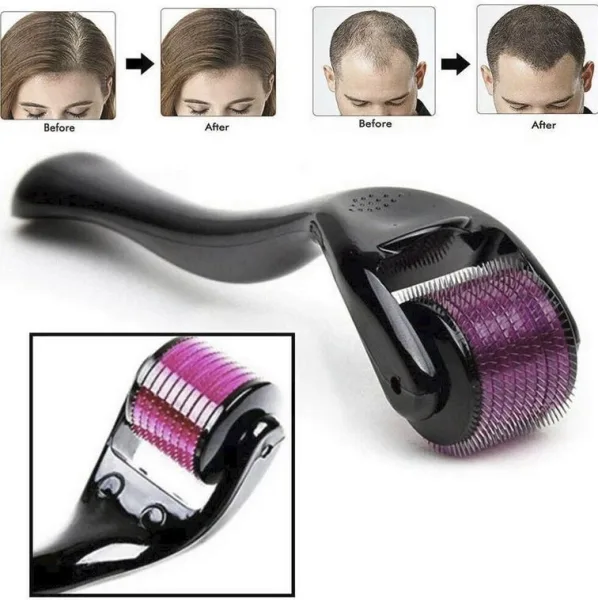 Derma Roller with Sanitizer Derma Roller for Hair Growth & Thickening, Repair Damages and Activates | 1281