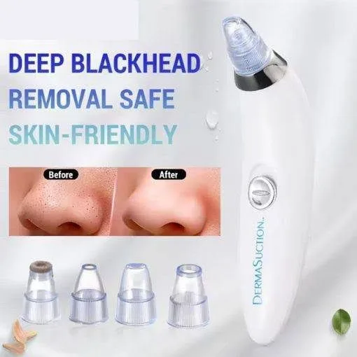 Derma Suction Pore Cleaning Device Blackhead Remover & Skin Detox with Vacuum Action for Glowing Ski | 61475